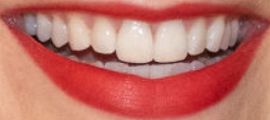 Picture of Lily Collins teeth and smile