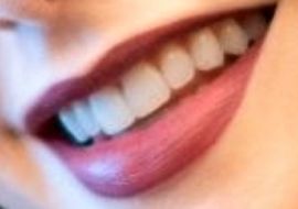 Picture of Lily Collins teeth and smile