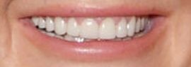 Picture of Lindsey Lohan teeth and smile