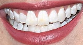 Picture of Linsey Godfrey teeth and smile