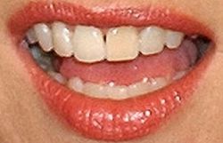 Picture of Lisa Kudrow teeth and smile