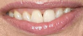 Picture of Lisa Kudrow teeth and smile