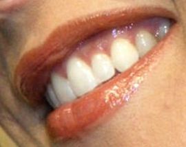 Picture of Lisa Marie Presley teeth and smile