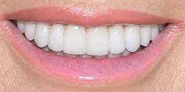 Picture of Lisa Vanderpump teeth and smile