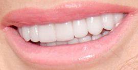 Picture of Lisa Vanderpump teeth and smile