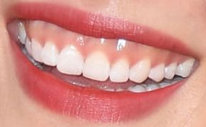 Picture of Liu Wen teeth and smile