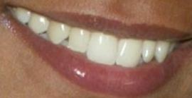 Picture of Liya Kebede teeth and smile