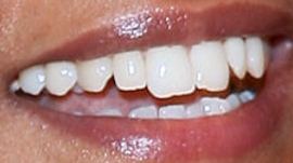 Picture of Liya Kebede teeth and smile