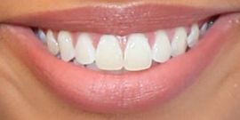 Picture of Lori Harvey teeth and smile