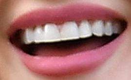 Picture of Lucy Hale teeth and smile