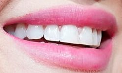 Picture of Lucy Hale teeth and smile