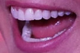 Picture of Lucy Lawless teeth and smile