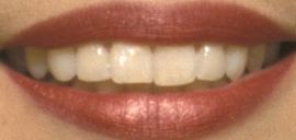 Picture of Lucy Liu teeth and smile