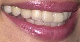 Picture of Lucy Liu teeth and smile