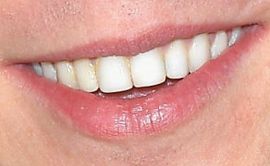 Picture of Lukas Gage teeth and smile