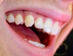 Picture of Luke Hemmings teeth and smile