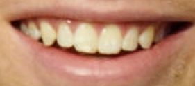 Picture of Luke Hemmings teeth and smile