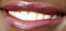 Picture of Lupita Nyong'o teeth and smile