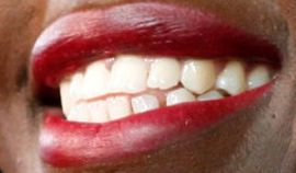 Picture of Lupita Nyong'o teeth and smile
