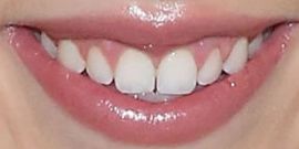 Picture of Madison Maddie Marlow teeth and smile