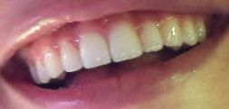 Picture of Madison Beer teeth and smile