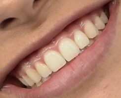 Picture of Madison Beer teeth and smile