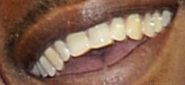Picture of Mahershala Ali teeth and smile