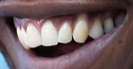 Picture of Mahershala Ali teeth and smile