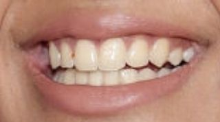 Picture of Maitreyi Ramakrishnan teeth and smile