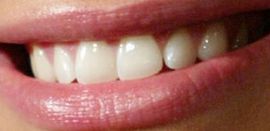Picture of Maria Menounos teeth and smile