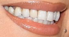Mariah Carey's teeth