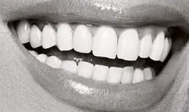Mariah Carey's teeth and smile