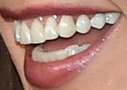 Picture of Marie Osmond teeth and smile