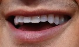 Picture of Mario Lopez's teeth and smile while smiling
