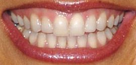 Picture of Mariska Hargitay teeth and smile