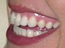 Picture of Mariska Hargitay teeth and smile