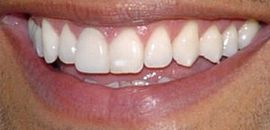 Picture of Mark Consuelos teeth and smile