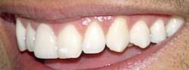 Picture of Mark Consuelos teeth and smile