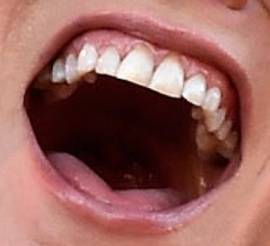 Picture of Martina McBride teeth and smile