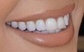 Picture of Mary Fitzgerald teeth and smile