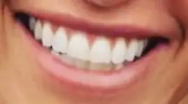 Picture of Mary Fitzgerald teeth and smile