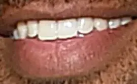 Picture of Bachelor Matt James teeth and smile