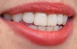 Picture of Maya Hawke teeth and smile