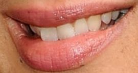 Picture of Maya Rudolph teeth and smile