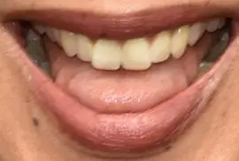 Picture of Maya Rudolph teeth and smile