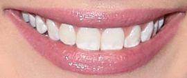 Picture of Meg Donnelly teeth and smile