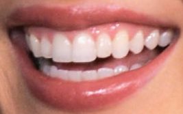 Megan Fox teeth