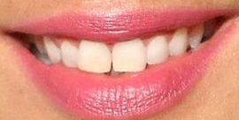 Picture of Megan Gale teeth and smile
