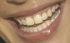 Picture of Megan Gale teeth and smile