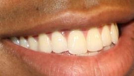 Picture of Mehcad Brooks teeth and smile